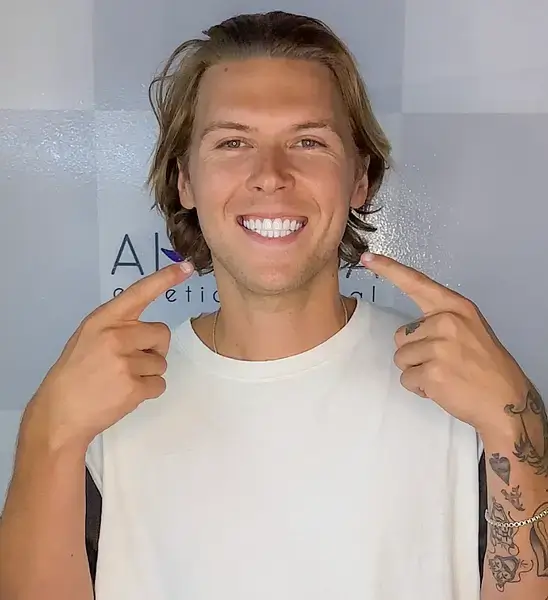 How to improve my smile without braces or long treatments