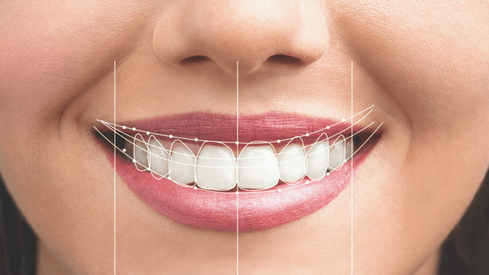 Stop Hiding Your Mouth: How to Have a Beautiful Smile at Any Age